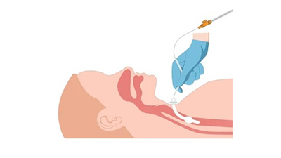 Critical Care